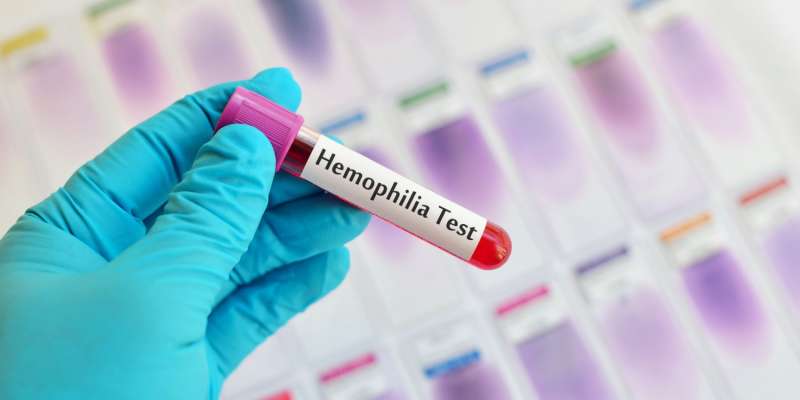 Hemofili Nedir? Hemofili Hastaları Nelere Dikkat Etmeli?
