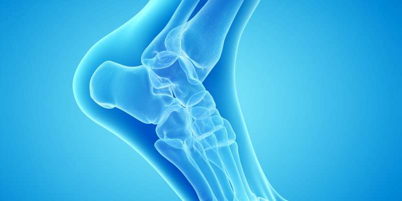 Peroneal Tendon Yırtığı Nedir ve Tedavi Yöntemleri Nelerdir?