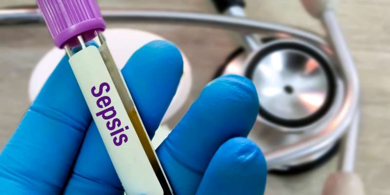 Sepsis Nedir? Belirtileri ve Tedavi Yöntemleri Nelerdir?